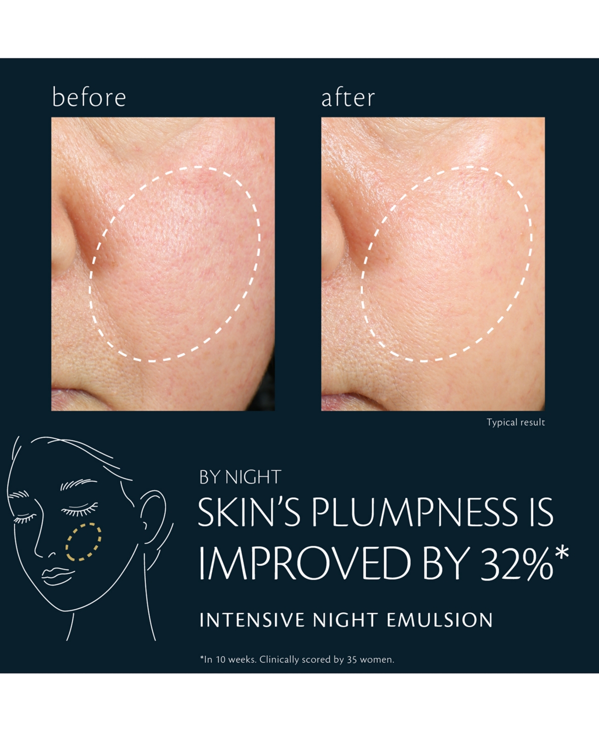 Clé De Peau Beauté Cle De Peau Beaute Intensive Night Emulsion 4.2 Oz. In Transparent