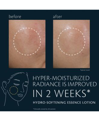 Hydro-Softening Essence Lotion Refill, 5.7 oz.