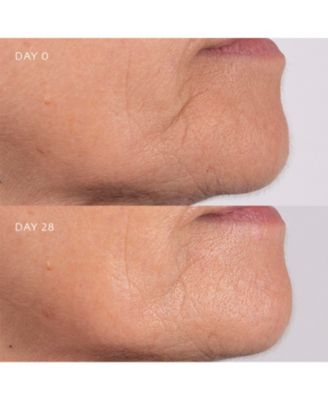 Freedom of Expression - Line Limiter - 15ml