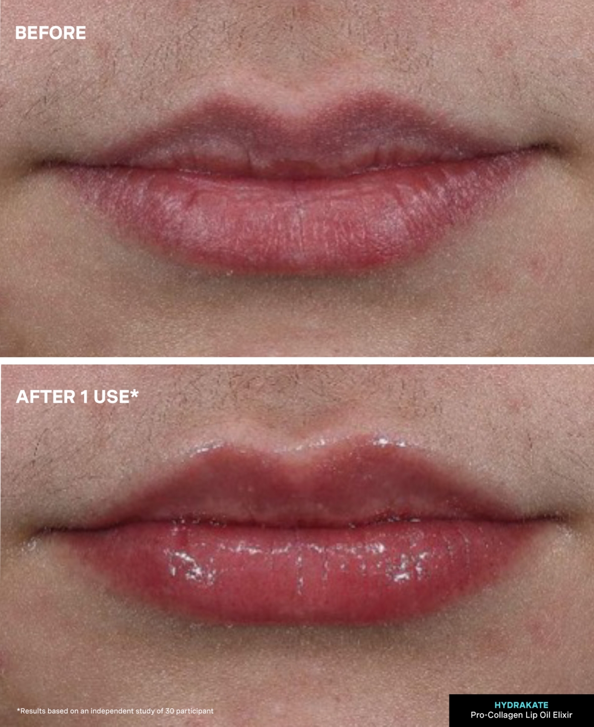 Kate Somerville Hydrakate Lip Oil Elixir, 0.24 Oz. In Transparent