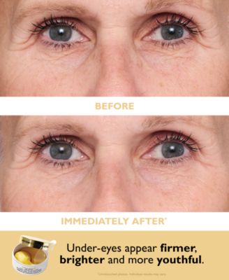 Patch + Go Eye Patch Travel Pack