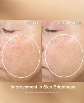 Super C Retinol Brighten and Correct Vitamin C Serum, 1oz