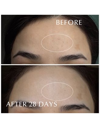 Excia Brightening Immaculate Serum Z