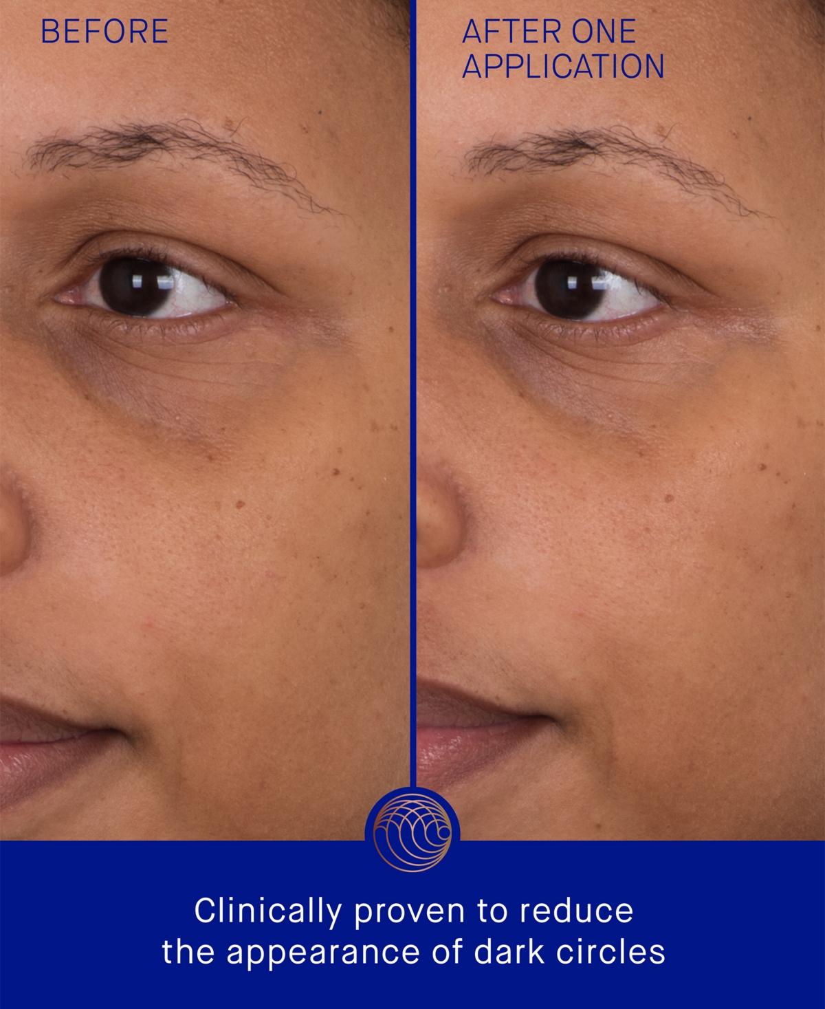 Augustinus Bader The Eye Patches, Pack of 6