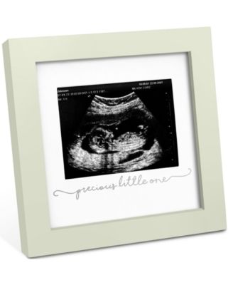 Solo Baby Sonogram Picture Frame, Modern Ultrasound Picture Frames, Pregnancy Announcements Sonogram Frame