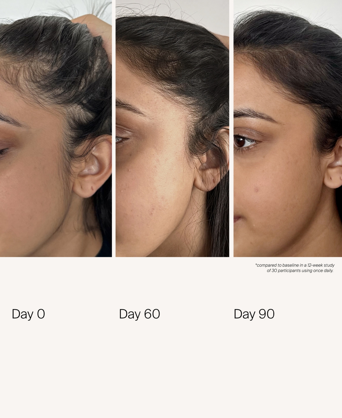 Living Proof Scalp Care Density Serum, 1.7 oz.