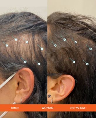 2-Pc. Revita High-Performance Hair Density Shampoo and Conditioner Jumbo Kit