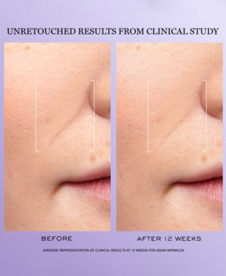 3-Pc. R&eacute;nergie H.C.F. Triple Serum Discovery Set