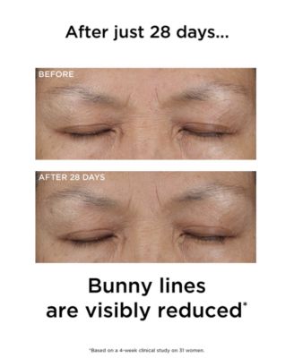 PREVAGE 3-in-1 Reset Serum, 1 oz.