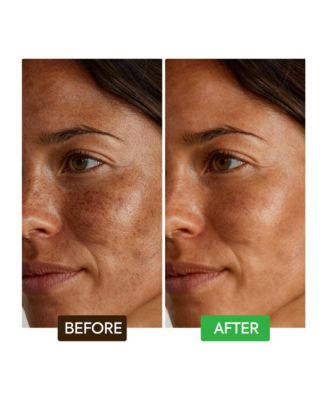 Kojic Acid Dark Spot Remover Soap Bars - 2 Pack