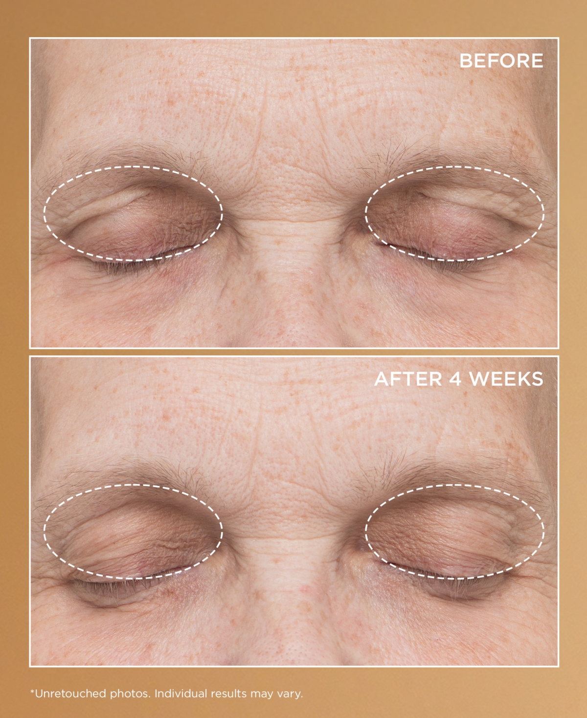 Perricone Md Neuropeptide Eyelid Lift Serum, 0.5 oz.