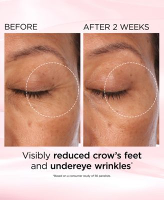 Retinol + HPR Ceramide Capsules Rapid Skin Renewing Eye Cream, 0.5 oz.