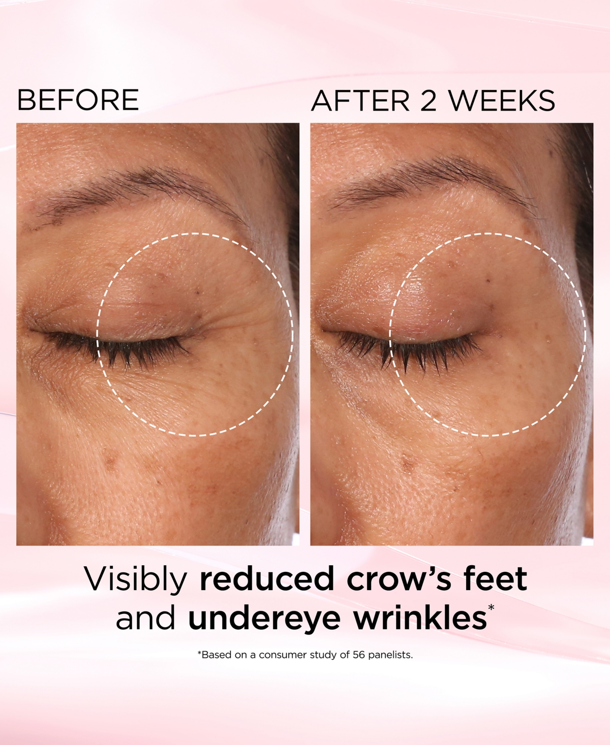 Elizabeth Arden Retinol + Hpr Ceramide Capsules Rapid Skin Renewing Eye Cream, 0.5 oz.