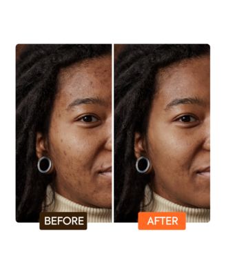 Extreme Argan & Carrot Oil Skin To Love - Skin Care Kit