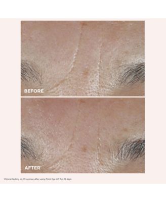 2-Pc. Face and Eyes Anti-Aging Gift Set