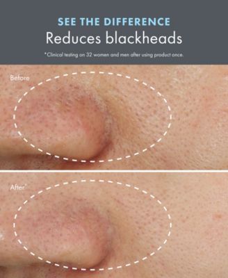 Clear Improvement Blackhead Clearing Mask-To-Scrub