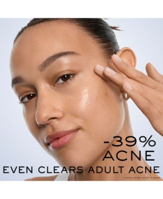 Clarifique Bx-Interceptor Acne Treatment, 1 oz.