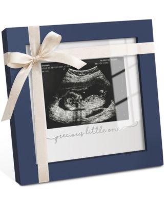Solo Baby Sonogram Picture Frame, Modern Ultrasound Picture Frames, Pregnancy Announcements Sonogram Frame