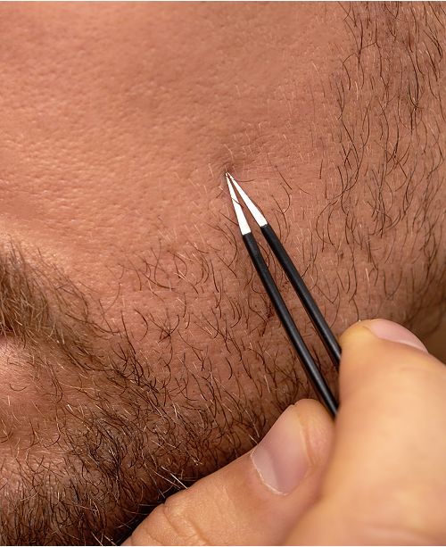 Tweezerman Gear Men S Ingrown Hair Splintertweeze Tweezer