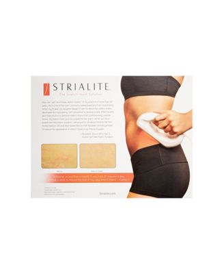 Stretchmark Device