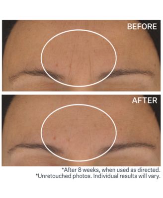 S.T.A.R. Light Retinol Night Oil, 1-oz.