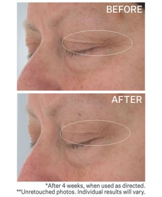 Hyaluronic Tripeptide Gel-Cream For Eyes, 0.5-oz.