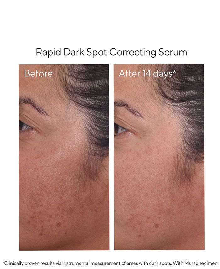 Murad - 4-Pc. Brighten Trial Set