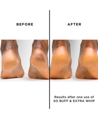 Extra Whip Hand & Foot Treatment With Shea Butter, 1-oz.