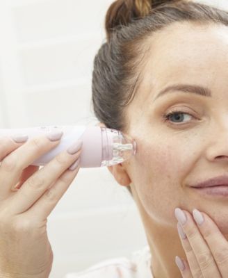 Personal Microderm Elite Pro