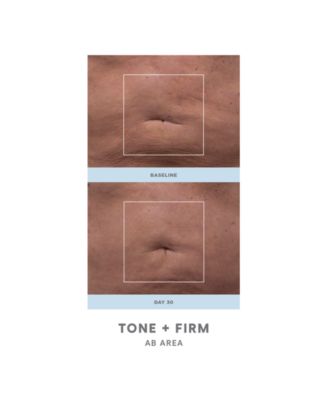 2-Pc. NuBODY Skin Toning Device Set