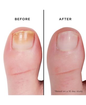 Mellow The Yellow Nail Brightening Treatment