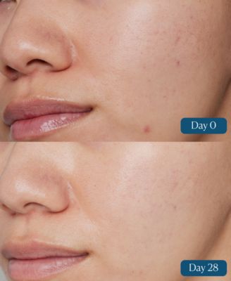 Dynamic Resurfacing Super-C Serum, 1 oz.