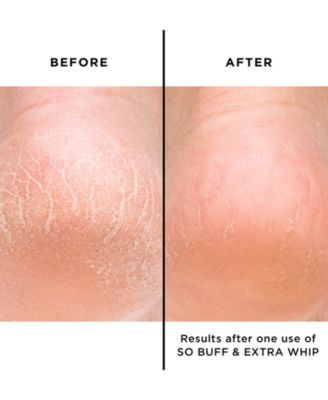 Jumbo So Buff Hand & Foot Polish With Glycolic Acid, 7 oz.