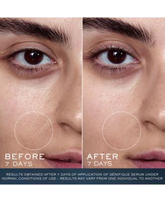 Lancôme 3-Pc. Strengthening & Repairing Skincare Set