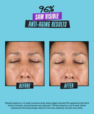 Super Multi-Corrective Anti-Aging Face & Neck Soft Cream, 2.5 oz.