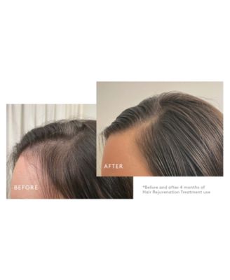 3-Pc. Trial-Size Hair Rejuvenation Treatment Set