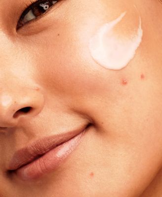 EradiKate Acne Mark Fading Gel, 1 oz.