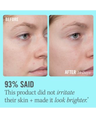 10% Vitamin C Brightening Serum