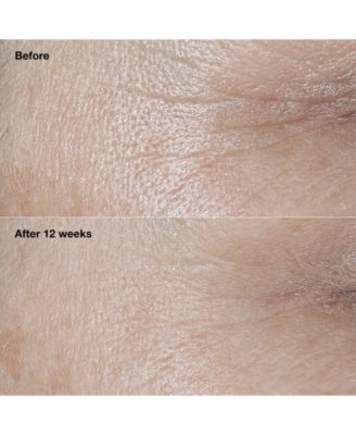 Smart Clinical Repair Wrinkle Correcting Cream SPF 30, 1.7 oz.