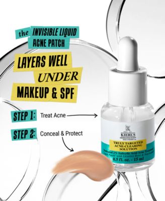 Truly Targeted Acne-Clearing Solution