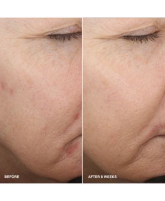 Vitamin Enriched Smoothing Niacinamide + Vitamin C Serum, 1 oz.