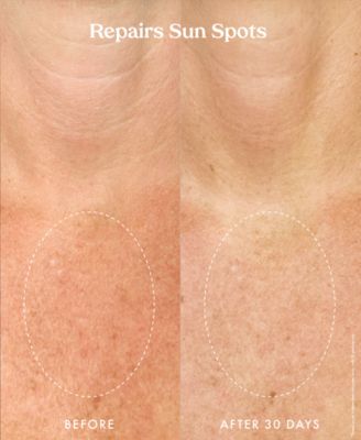 Ultra Renewal Retinol Body Cream, 4.7 oz.