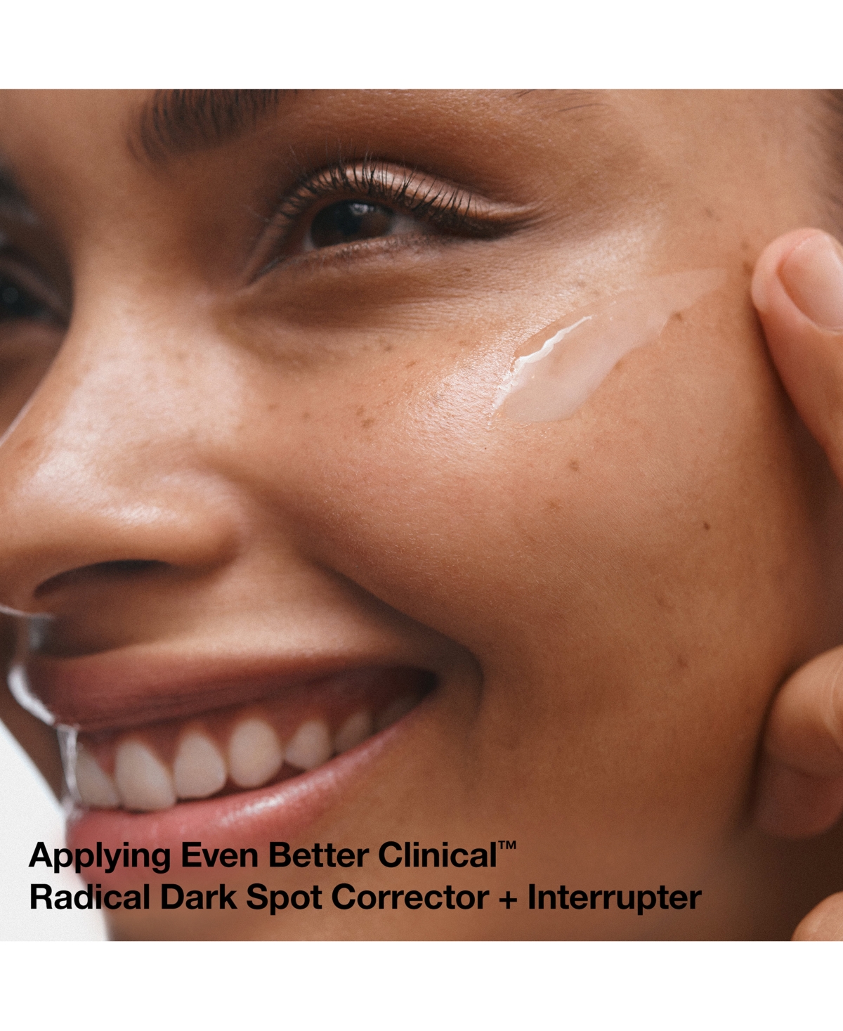 Shop Clinique 4-pc. Even Tone Experts Brightening Skincare Set In No Color