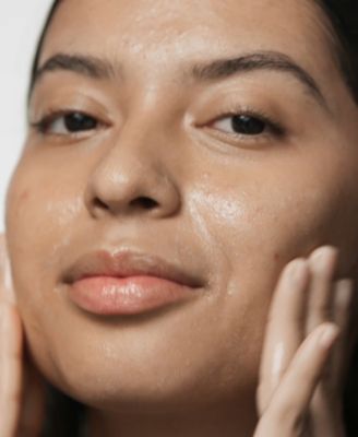 Acne Solutions Cleansing Gel, 4.2 oz.