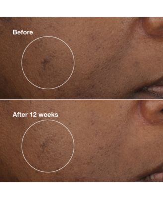 Even Better Clinical Brightening Moisturizer, 1.7 oz.