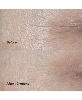 Smart Clinical Repair Wrinkle Correcting Face Cream, 1.7 oz.