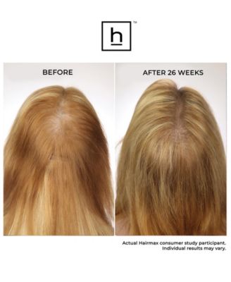 Ultima 9 Classic Lasercomb