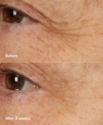 Smart Clinical Repair™ Overnight Recovery Face Cream + Mask, 1.7 oz