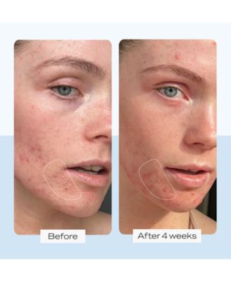 First Aid Beauty Ultra Repair Cream, 6-oz.