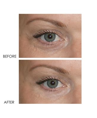 REVITALITE PROFESSIONAL Eyelid & Dark Circle Corrector